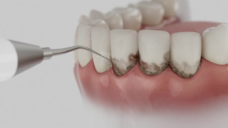 Reliable Dental contractor in Prichard, AL by Smile Center Dentistry